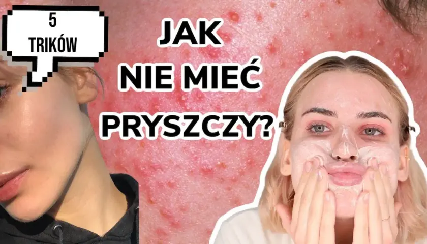 Gładka cera bez pryszczy? Odkryj sekrety eksperta!