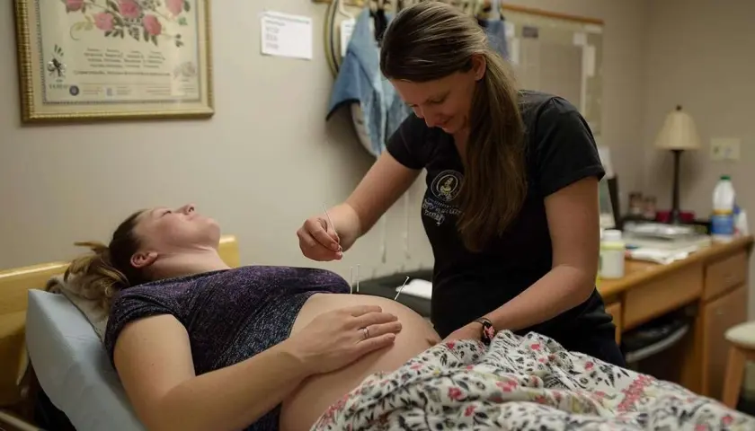 Une praticienne applique des aiguilles d'acupuncture sur le ventre d'une femme enceinte, une approche douce pour l'accouchement.
