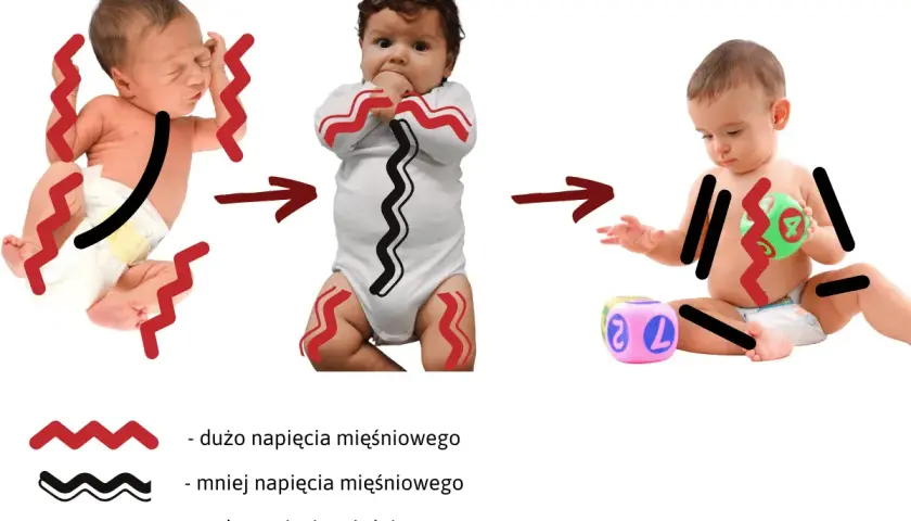 Trzy etapy rozwoju niemowlęcia: od wzmożonego napięcia mięśniowego, przez zmniejszone, aż do swobodnych ruchów.