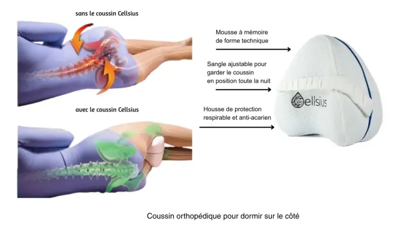 Comparaison de la posture du bassin : sans coussin, la colonne vertébrale est tordue, causant lombo-sacré douleur. Avec le coussin, l'alignement est parfait.