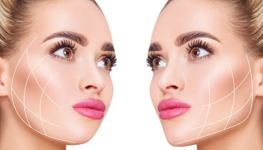 Dos rostros femeninos con líneas de contorno facial, sugiriendo tratamientos estéticos para el "ozempic face".