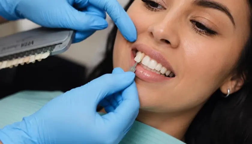 Dobór idealnego odcienia licówek kompozytowych. Dentysta porównuje kolor zębów pacjentki z wzornikiem.
