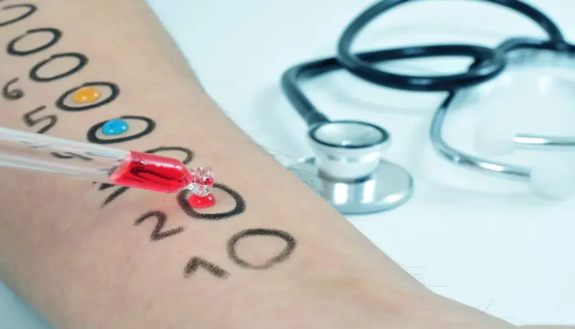 Czy testy alergiczne są na NFZ? Sprawdź, co musisz wiedzieć