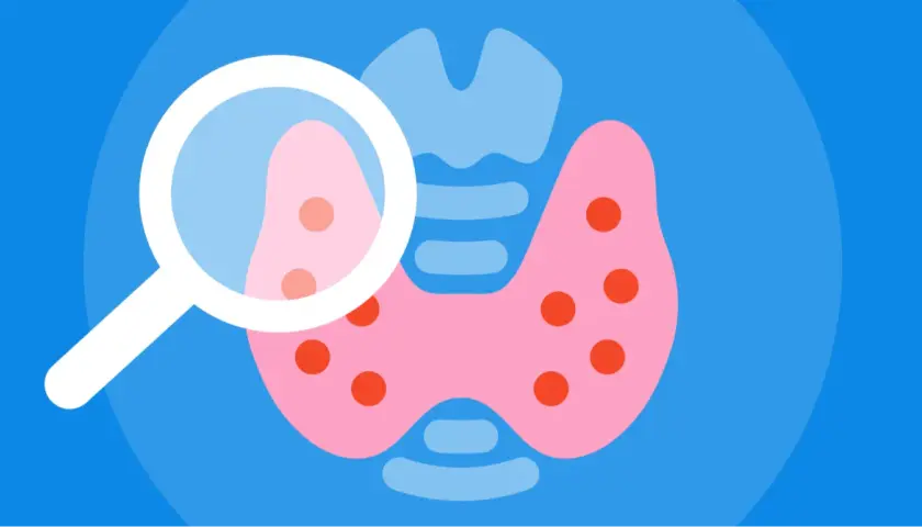 Ilustracja przedstawia tarczycę pod lupą, sugerującą diagnostykę subklinicznej niedoczynności tarczycy.