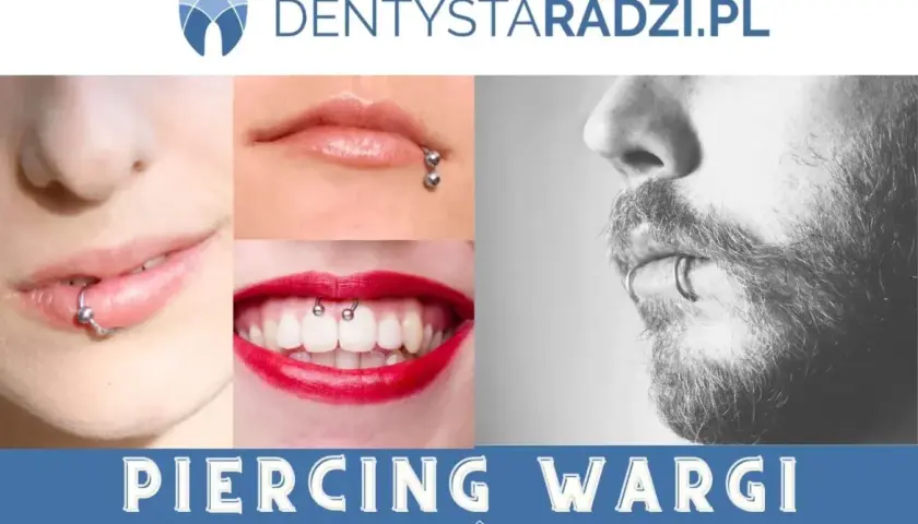 Kolczyk Smiley: Uśmiechnięty sekret wędzidełka. Czy jest bezpieczny?