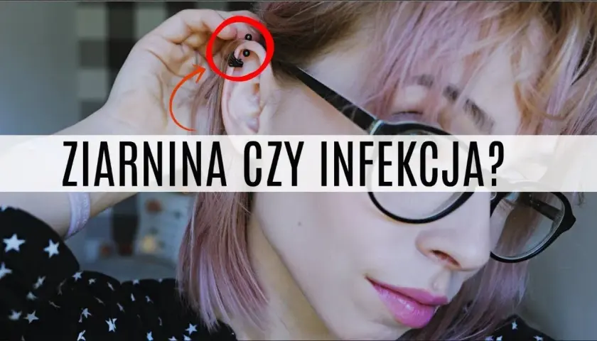 Jak leczyć infekcję po piercingu: skuteczne metody i porady