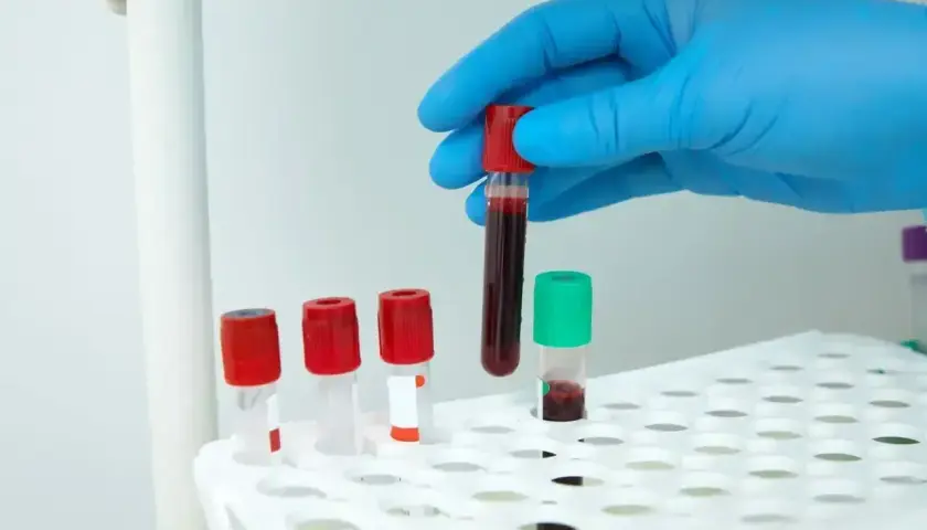 Ręka w niebieskiej rękawiczce trzyma probówkę z krwią nad stojakiem z próbówkami.