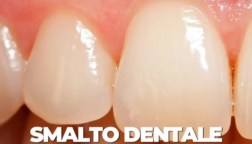 Primo piano di denti sani, con smalto lucido e gengive rosa. Un esempio di smalto dentale forte, pronto per la remineralizzazione.