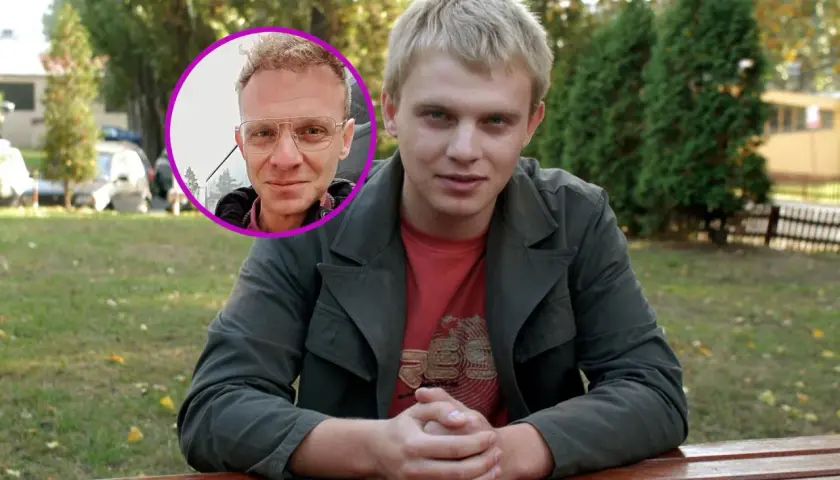 Kazimierz Mazur po przeszczepie włosów, porównanie wyglądu przed i po.