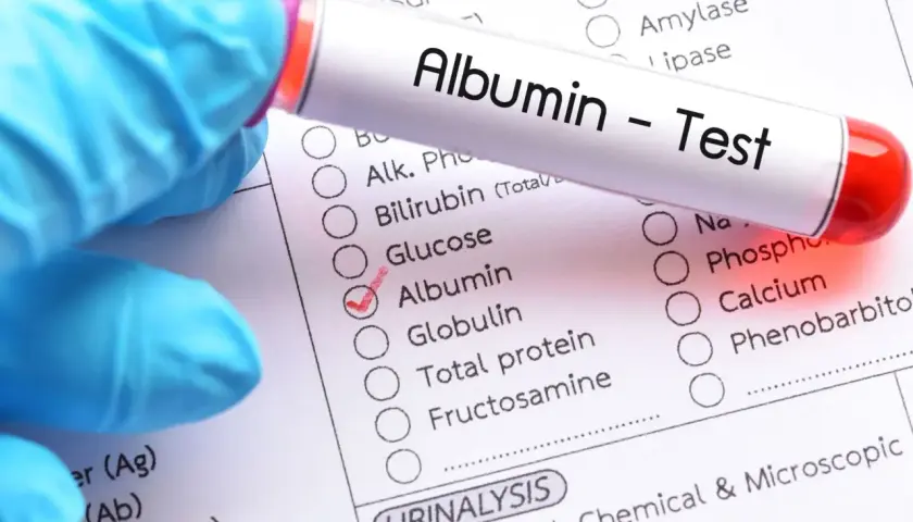 Rękawiczka w niebieskiej rękawiczce trzyma probówkę z napisem "Albumin - Test". Obok zaznaczono "Albumin" na liście badań.