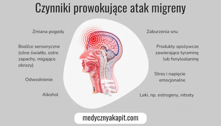 Grafika przedstawia czynniki wywołujące atak migreny, w tym zmiany pogody, bodźce sensoryczne, stres i produkty spożywcze. Może to być pomocne dla osób doświadczających migreny z aurą.