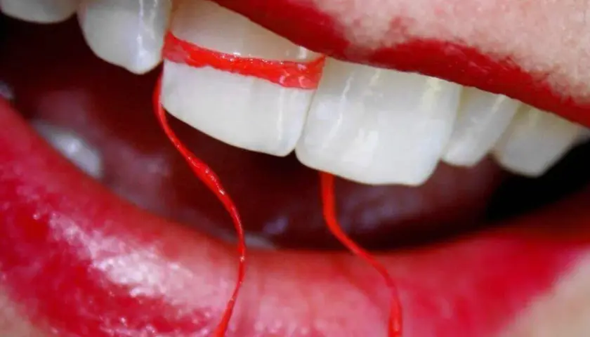 Denti bianchi con filo interdentale rosso stretto tra due, sembra che il filo interdentale faccia male.
