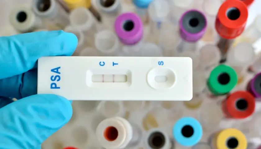 Rękawiczka trzyma test PSA, który wskazuje wynik. W tle widać probówki, co sugeruje badanie psa i przygotowanie do analizy.