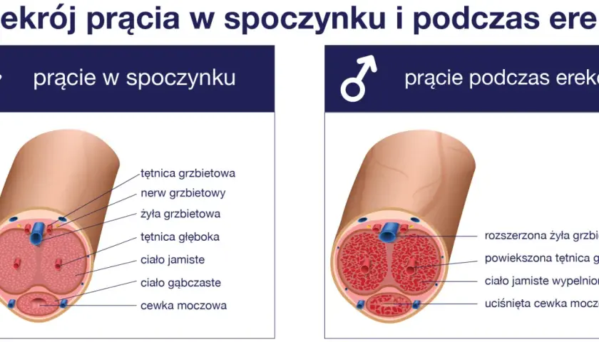 Przekrój prącia w spoczynku i podczas erekcji. Brak erekcji może być oznaką impotencji, co ilustruje obraz.