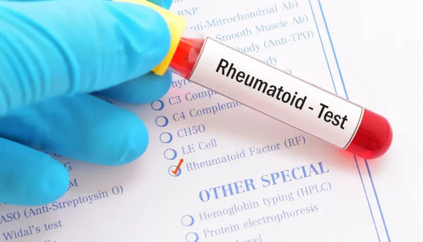 Rękawiczka w niebieskiej rękawiczce trzyma probówkę z napisem "Rheumatoid - Test". Zaznaczono "Rheumatoid Factor (RF)", co sugeruje, że to badanie na obecność czynnika reumatoidalnego.