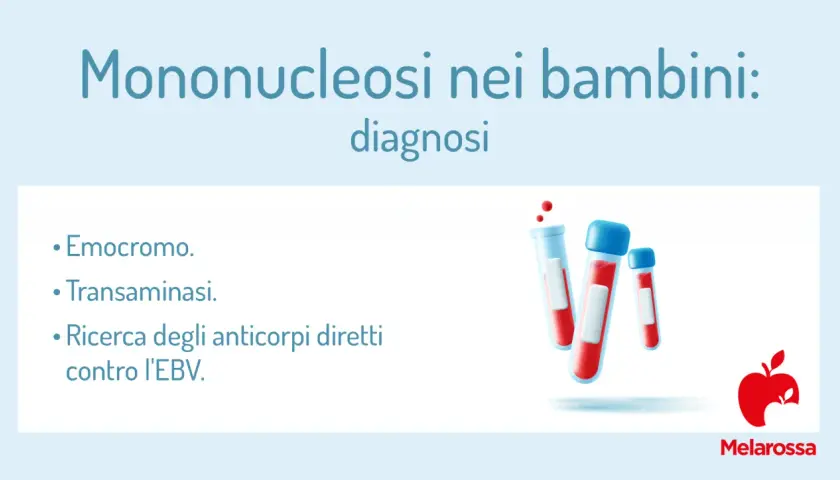 Diagnosi di mononucleosi nei bambini: emocromo, transaminasi e ricerca anticorpi contro l'EBV (Epstein Barr virus).