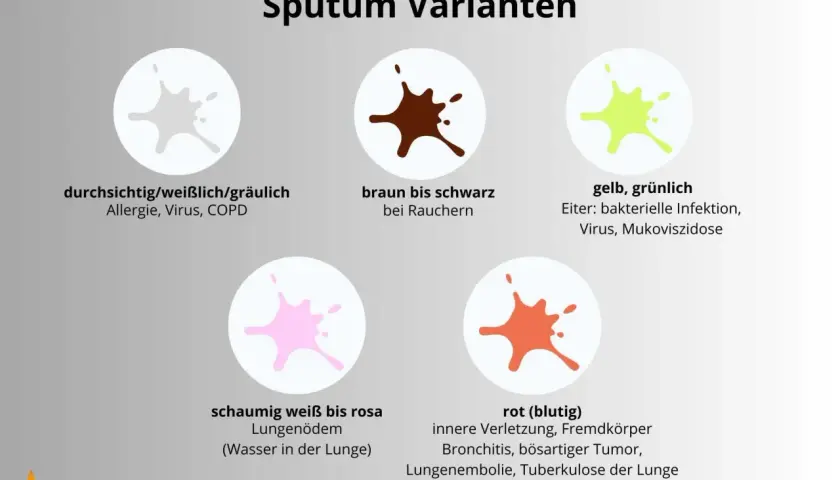 Gelb, grünlich: Eiter bei bakterieller Infektion, Virus, Mukoviszidose. Das Bild zeigt verschiedene Sputum-Varianten.