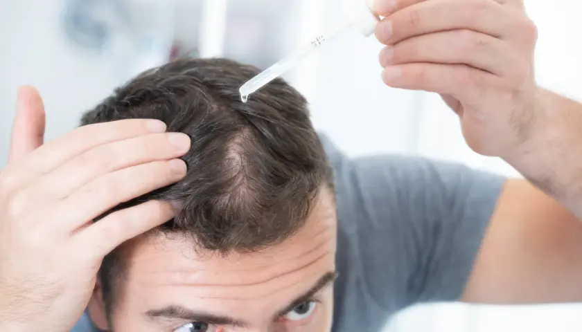Mężczyzna aplikuje serum na skórę głowy, próbując zaradzić problemowi rzadkich włosów.