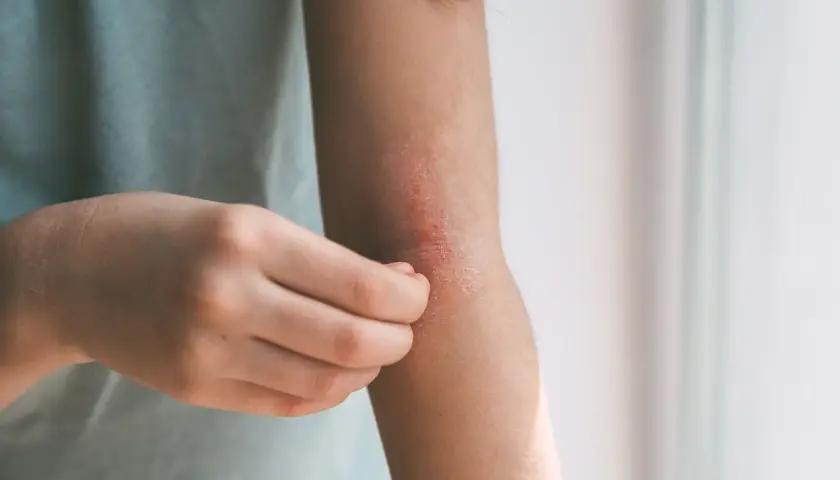Skóra na łokciu swędzi i jest zaczerwieniona. Czas na wizytę u dermatologa, by znaleźć przyczynę i ulgę.