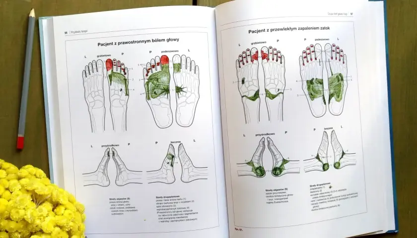 Ilustracje przedstawiające punkty stopy związane z bólem głowy i zapaleniem zatok.