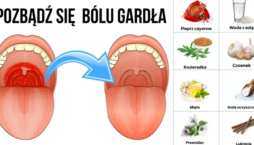 Jak zapobiec anginie - najskuteczniejsze sposoby na zdrowe gardło.