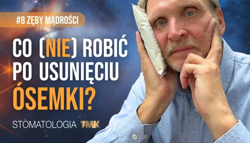 Koszt zdjęcia szwów z dziąsła: 50-150 zł? Czy zawsze płacisz?