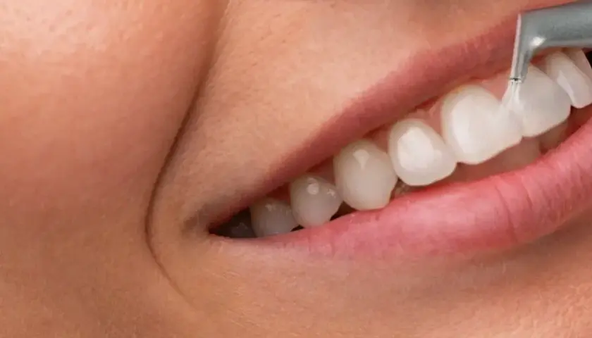 Profesjonalna higienizacja zębów. Dentysta czyści białe zęby strumieniem wody i powietrza, zapewniając idealny uśmiech.