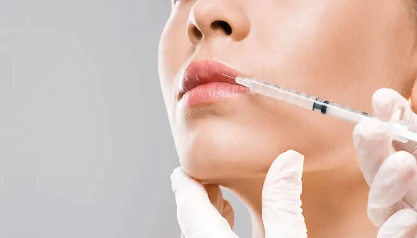 Dalle mani di un'estetista a quelle di un medico estetico: un primo piano di labbra che ricevono un trattamento di filler con siringa.