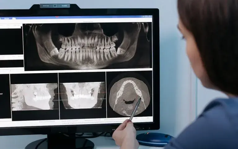 Czy dentysta widzi że ktoś pali? Objawy palenia, które zaskakują