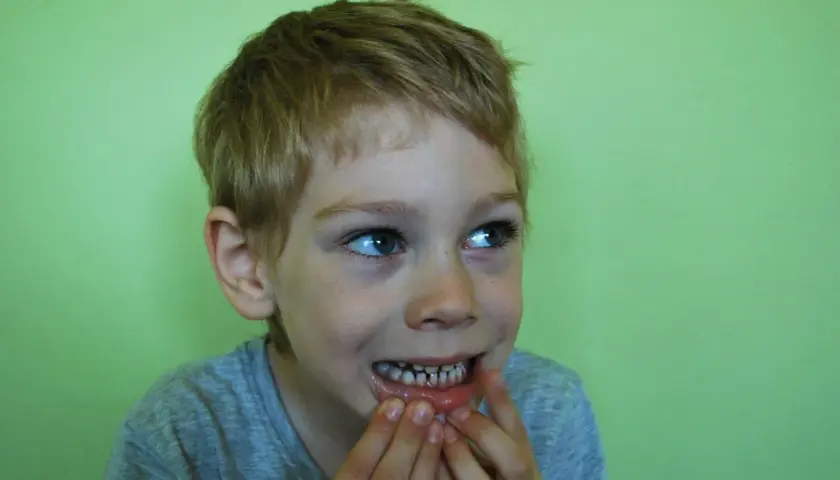 Bambino con denti sensibili, cerca un rimedio immediato.