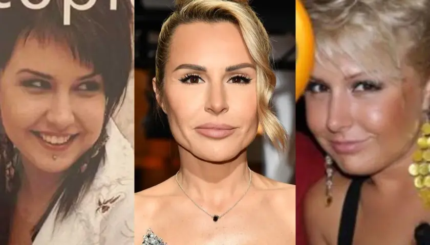 Trzy zdjęcia Blanka Lipińska przed operacjami. Widoczna metamorfoza twarzy i stylu.