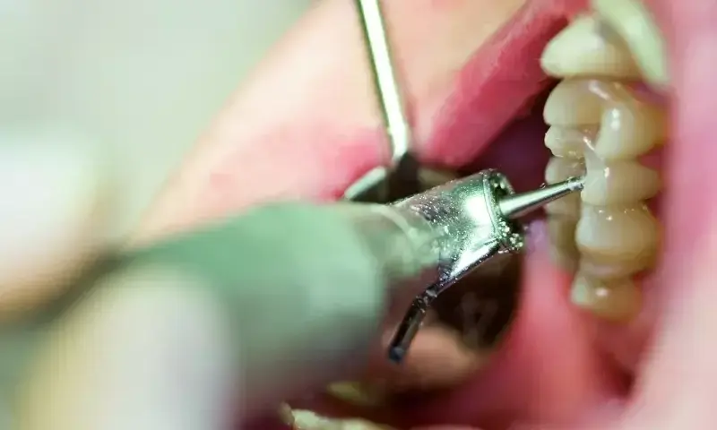 Czy dentysta może odmówić przyjęcia pacjenta z bólem zęba? Oto prawda