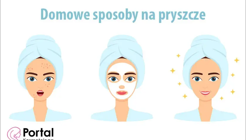 Co jest dobre na pryszcze? Sprawdzone metody i porady eksperta