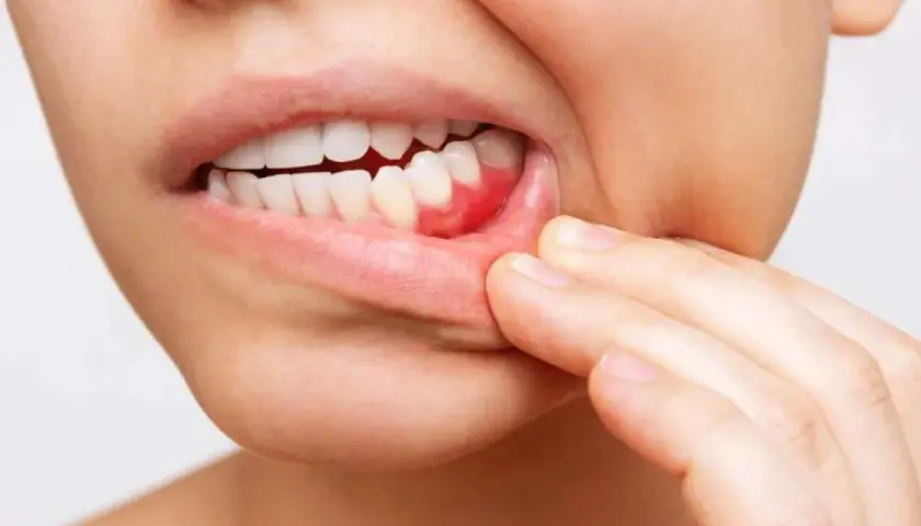 Gengive infiammate e mal di stomaco: un disagio che colpisce tutto il corpo.