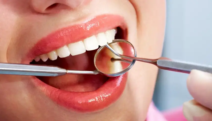 Uśmiech z błyszczącymi ustami i białymi zębami, badany lusterkiem dentystycznym. Czy bonding jest odwracalny?