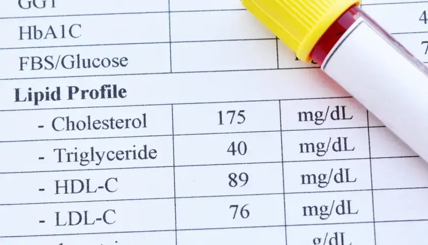 Wynik lipidogramu: cholesterol całkowity 175 mg/dL, HDL 89 mg/dL, LDL 76 mg/dL. Wartość cholesterolu nie-HDL jest podwyższona.