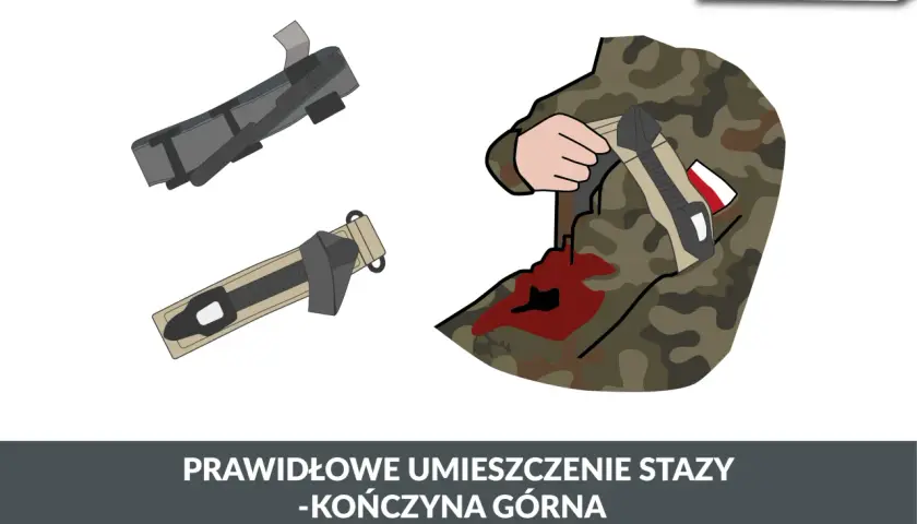 Ilustracja pokazuje, jak prawidłowo założyć stazę na kończynę górną żołnierza z raną.