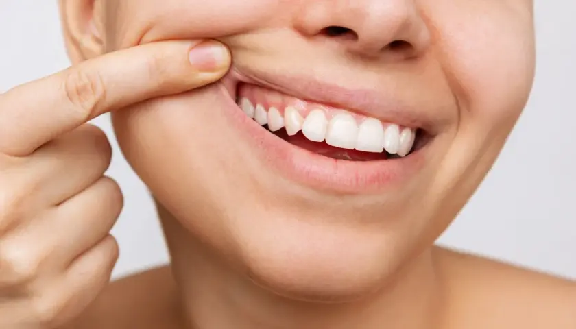 Dito con un dito, un sorriso mostra denti bianchi e **gengive normali**, segno di buona salute orale.