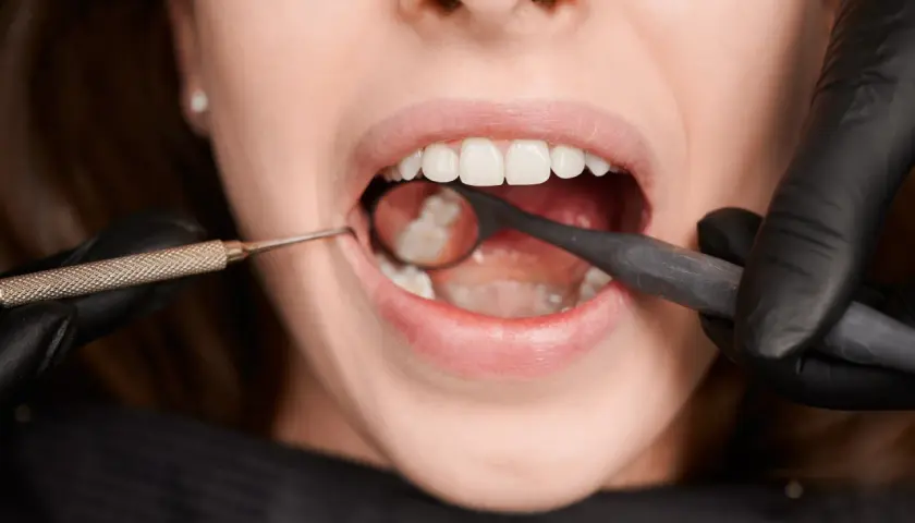 Zbliżenie na usta pacjentki podczas zabiegu ekstrakcji zęba. Dentysta w czarnej rękawiczce używa lusterka i narzędzia.