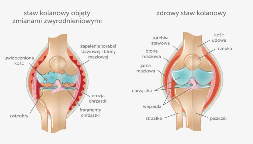 Ból kolan do jakiego lekarza? Sprawdź, kogo potrzebujesz!