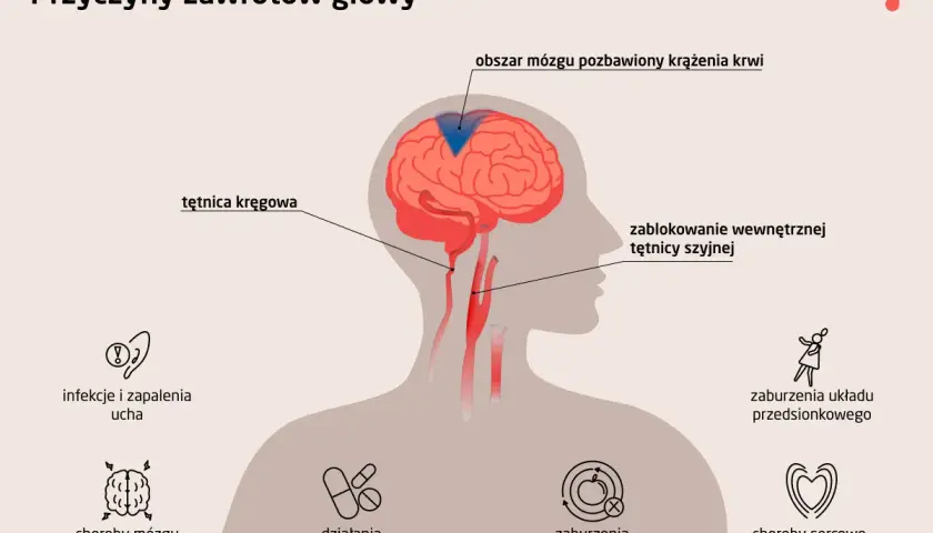Ilustracja przedstawia przyczyny zawrotów głowy i wymiotów: blokady tętnic, choroby mózgu, infekcje ucha, zaburzenia metaboliczne i sercowo-naczyniowe.