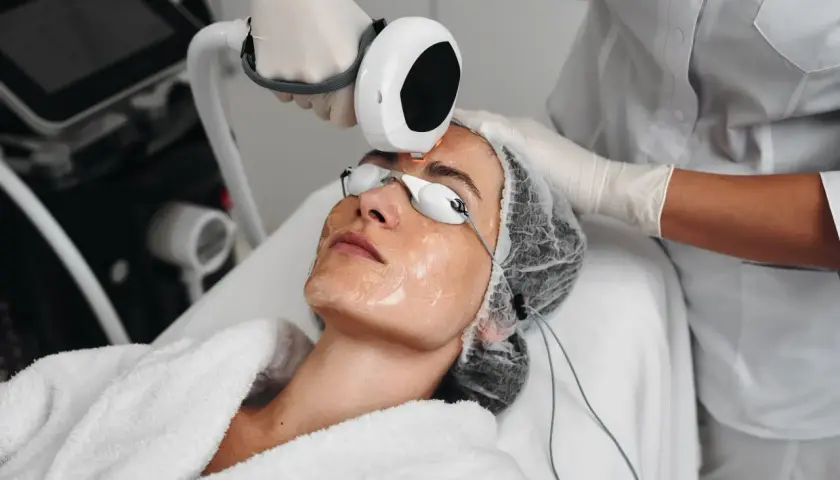 Trattamento estetico per come rimpolpare il viso con laser. Una persona con occhiali protettivi riceve un trattamento sul viso.