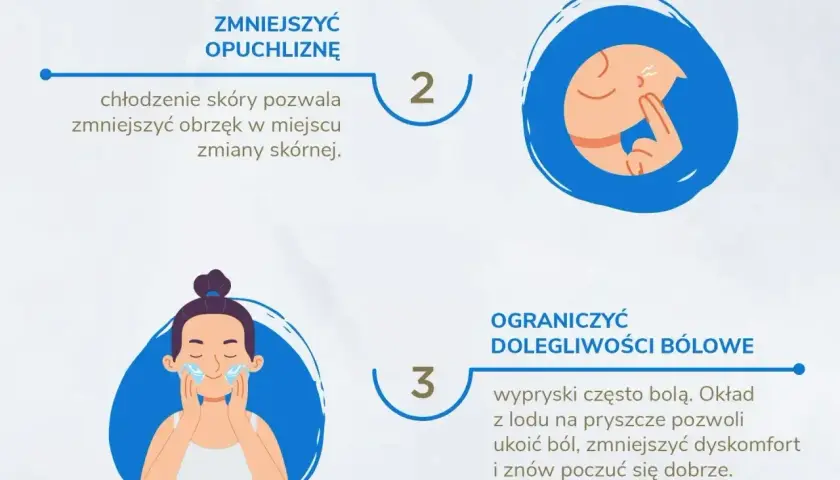 Jak pozbyć się pryszcza w kilka godzin? Chłodzenie skóry zmniejsza opuchliznę, a okład z lodu łagodzi ból.