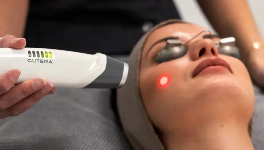 En kvinna får en behandling med laser genesis. En hand håller en laserapparat nära hennes ansikte, där en röd prick syns på kinden.
