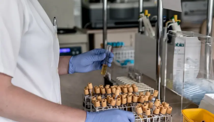 Laborantka w niebieskich rękawiczkach analizuje próbkę, która może zawierać informacje o poziomie dehydrogenazy mleczanowej.