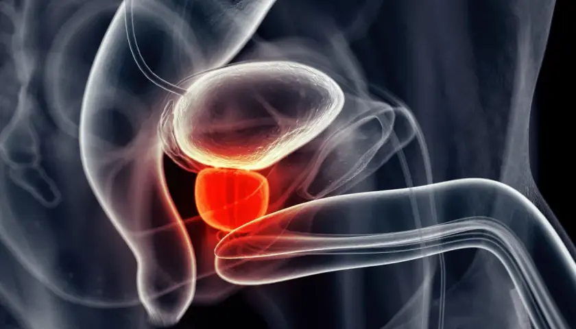 Anatomical illustration showing the bladder and prostate. The prostate is highlighted in red, suggesting inflammation or pain, relevant to understanding masaż prostaty.