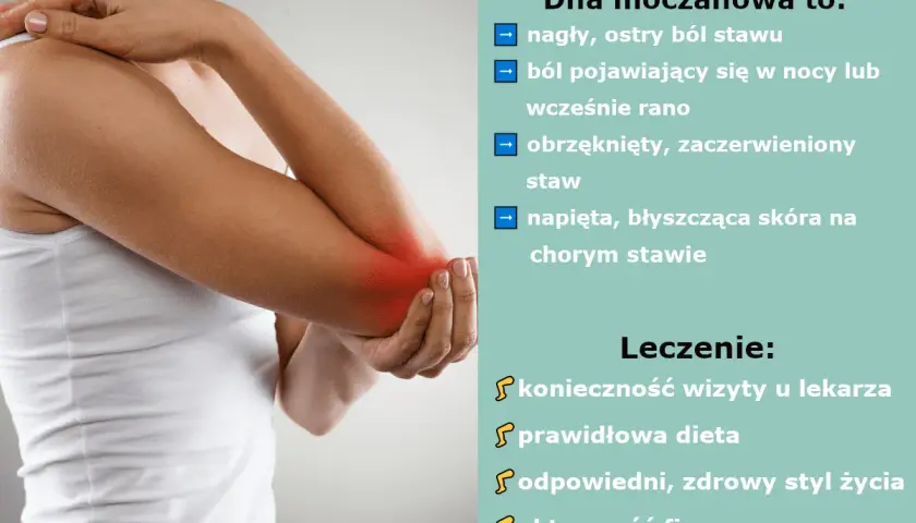 Dna moczanowa objawia się nagłym, ostrym bólem stawu, obrzękiem i zaczerwienieniem. Leczenie obejmuje wizytę u lekarza, dietę i zdrowy styl życia.