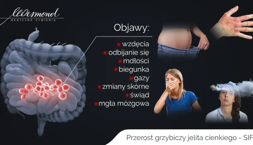 Ilustracja przedstawia jelita z czerwonymi skupiskami, symbolizującymi przerost grzybicy. Wymienione objawy to wzdęcia, mdłości, biegunka, gazy, zmiany skórne, świąd i mgła mózgowa.