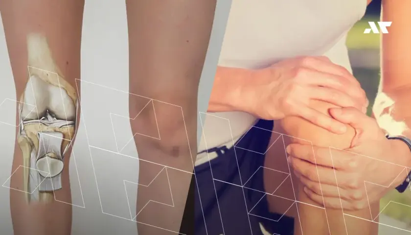 Anatomia kolana z widoczną rzepką i bólem odczuwanym przez osobę trzymającą się za kolano.