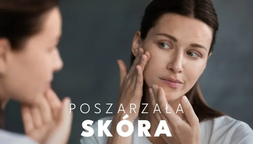 Kobieta dotyka swojej twarzy, analizując poszarzałą skórę.